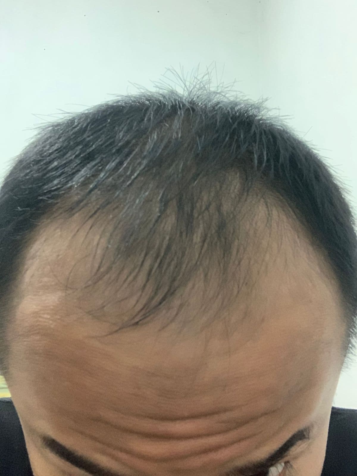 Before - Fahmi