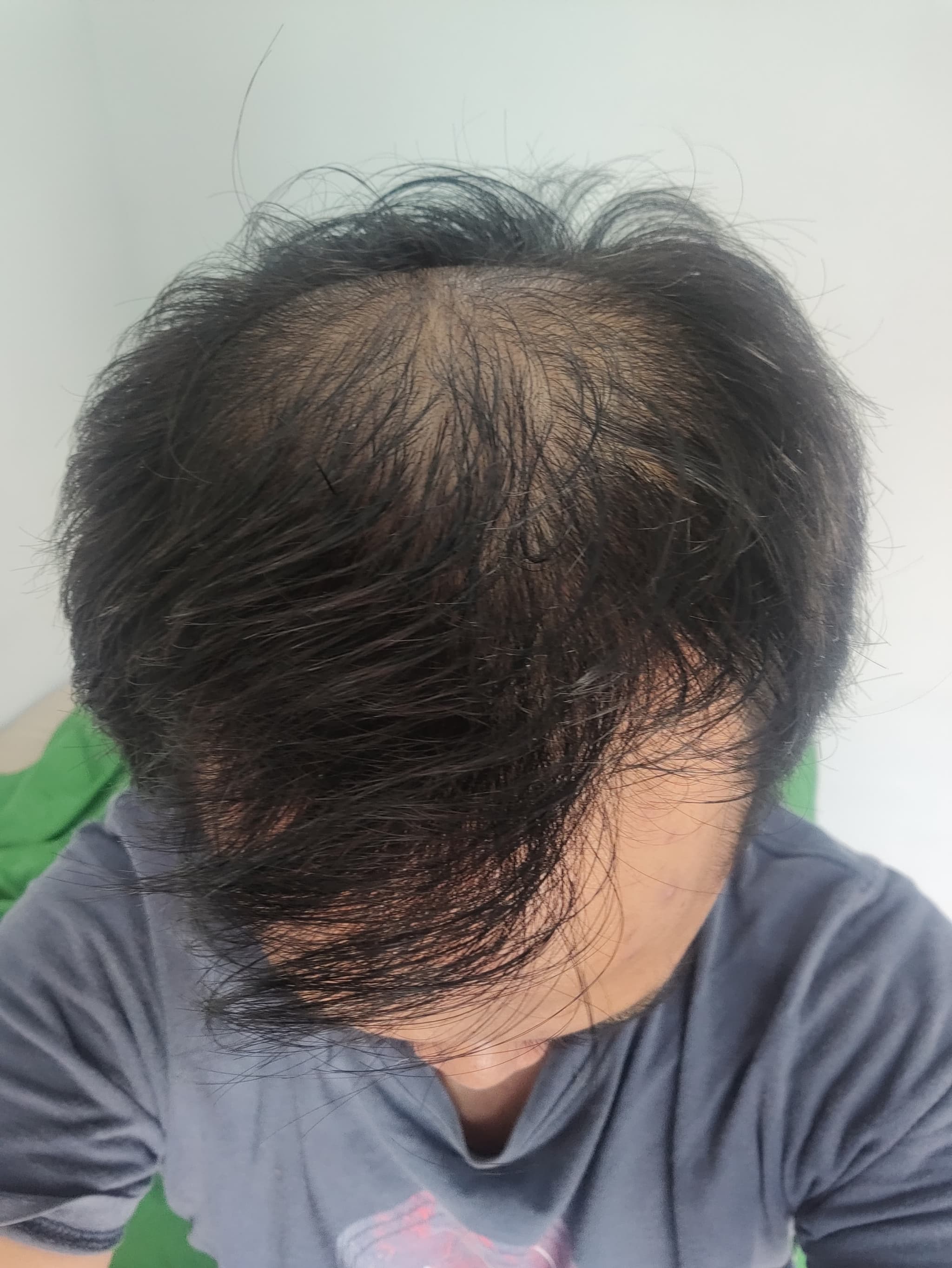 Before - Tio Fatrin